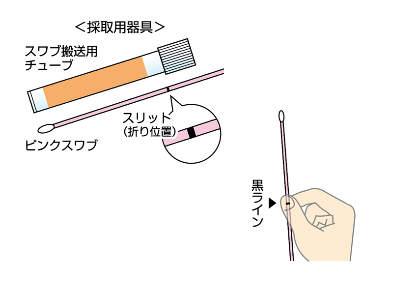採集セットを開封し、ピンクスワブを用意する
